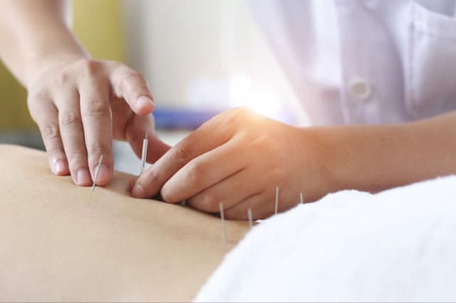 Châm cứu phục hồi sau tai biến có hiệu quả không?