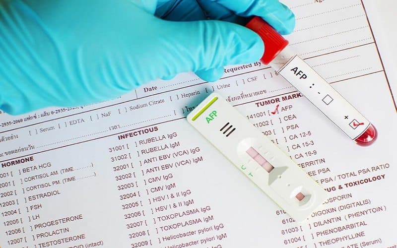 Các cách chẩn đoán u gan chính xác