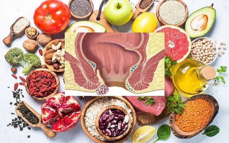 Chế độ ăn uống ảnh hưởng đến tình trạng bệnh, đặc biệt là nguy cơ táo bón và mức độ khó chịu khi đại tiện