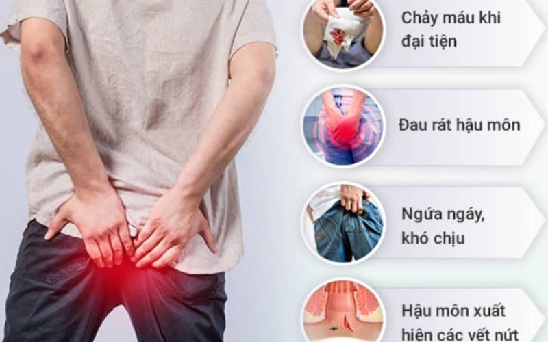 Chẩn đoán nứt kẽ hậu môn do táo bón chủ yếu dựa vào triệu chứng người bệnh gặp phải và kết quả khám trực tiếp vùng hậu môn
