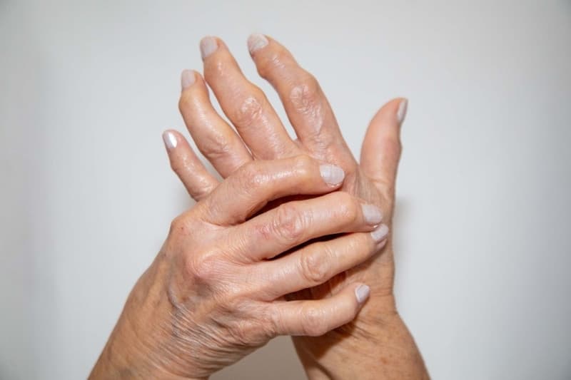 Khớp bàn tay, cổ tay và bàn chân bị ảnh hưởng thường sưng và đau nhức dai dẳng