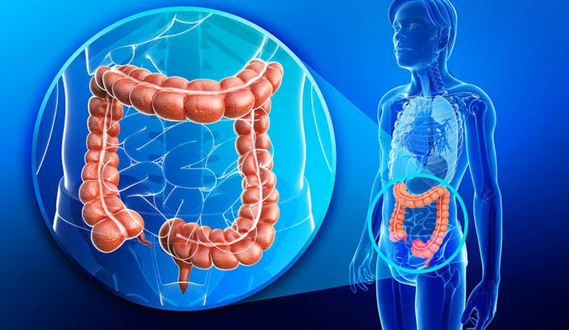 Viêm trực tràng không phải lúc nào cũng nguy hiểm