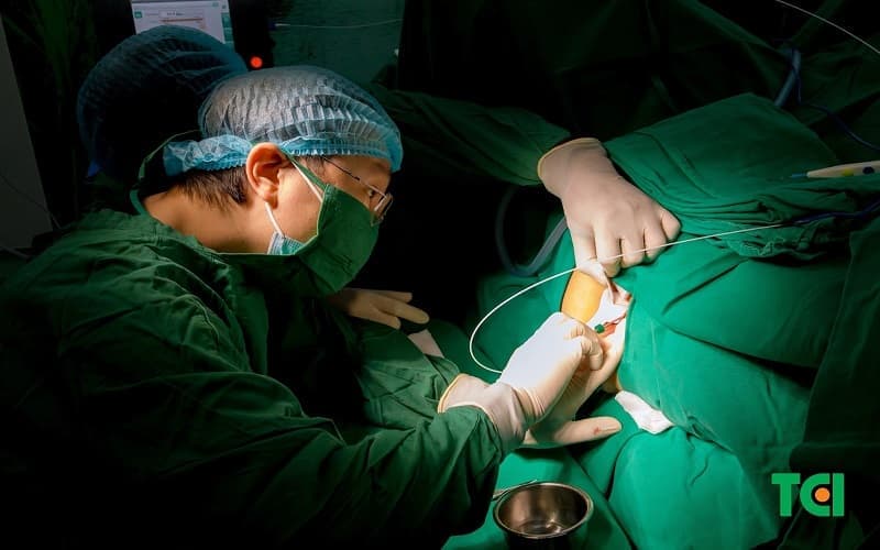 Phẫu thuật trĩ lâu năm khi búi trĩ lớn