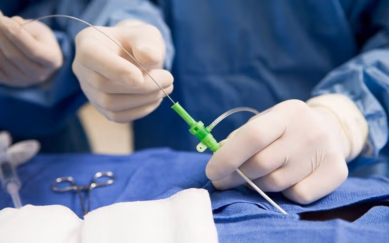 Tổng hợp những phương pháp điều trị u máu gan