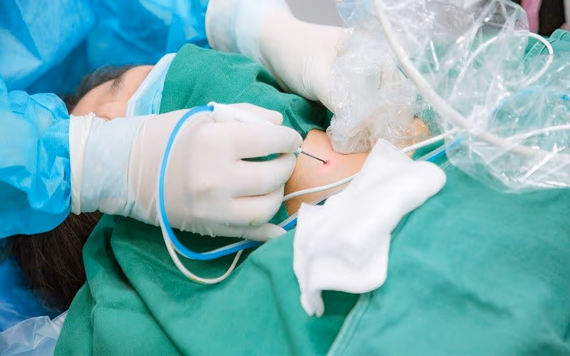 Những phương pháp điều trị u tuyến cận giáp chính