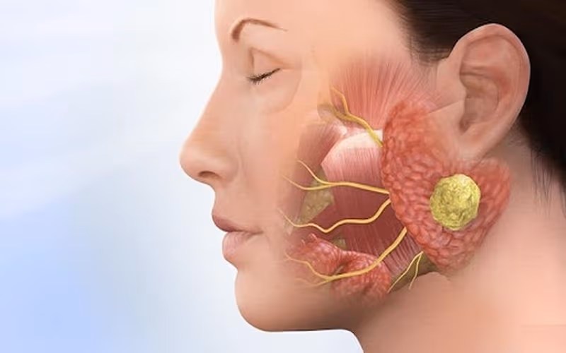 Những dấu hiệu cảnh báo bệnh ung thư biểu mô tuyến thực quản