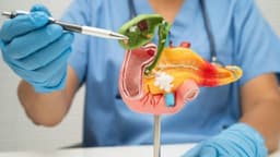 Điều trị viêm túi mật mạn: Phương pháp nào hiệu quả và an toàn?