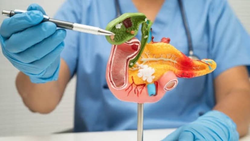 Điều trị viêm túi mật mạn: Phương pháp nào hiệu quả và an toàn?