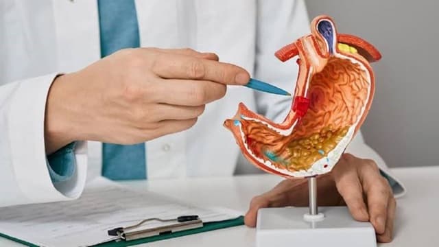 GIST dạ dày là gì? Dấu hiệu nhận biết, mức độ nguy hiểm và phương pháp điều trị