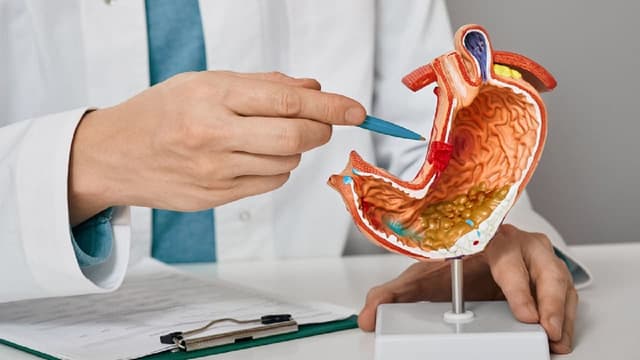 GIST dạ dày là gì và có nguy hiểm không?
