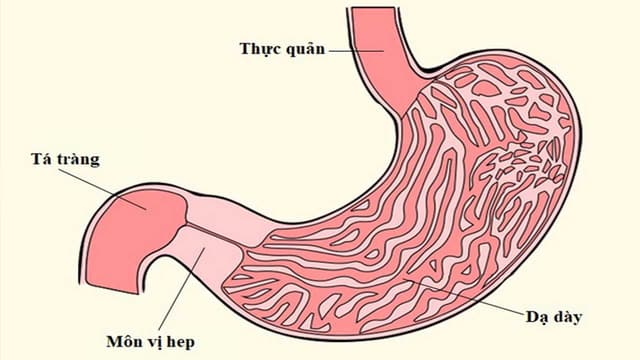 Hẹp môn vị là gì? Dấu hiệu hẹp môn vị nào cảnh báo cần đi khám ngay?