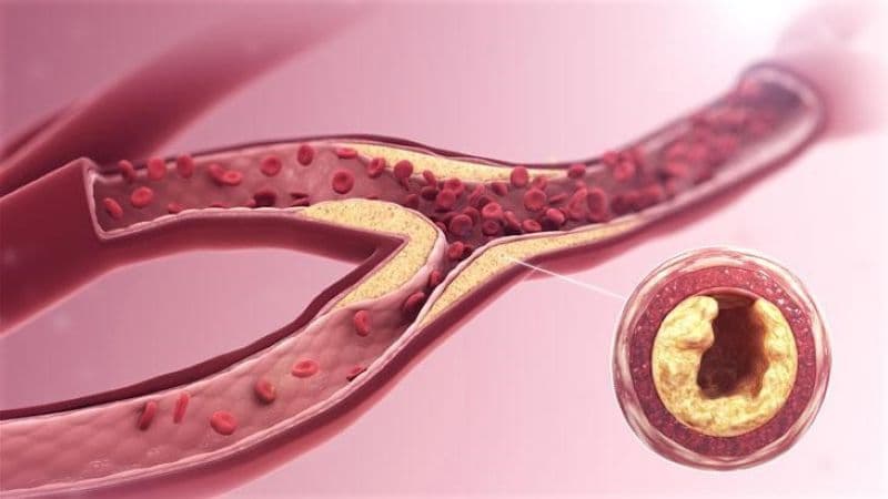 Huyết hư và thiếu máu có thể gây mệt mỏi, xanh xao nhưng không hoàn toàn đồng nhất