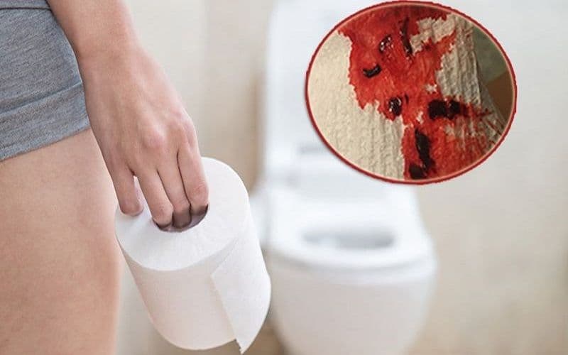 Một vài thông tin cần biết về tình trạng hẹp hậu môn