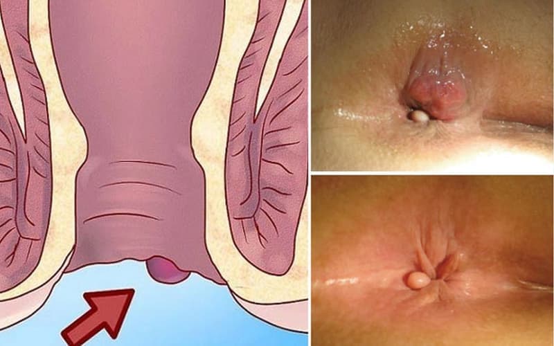 Theo dõi kích thước và triệu chứng giúp nhận biết những thay đổi bất thường của khối u