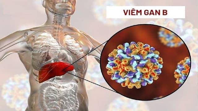Người bị viêm gan B có béo được không? Ăn gì để tăng cân an toàn