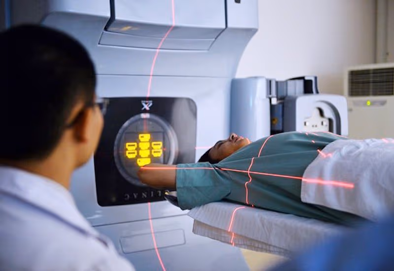 Nguyên nhân viêm trực tràng do tia xạ trực tiếp là tác động của tia xạ trong quá trình điều trị ung thư