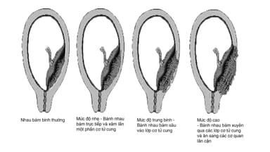 Biến chứng nhau cài răng lược nguy hiểm như thế nào?