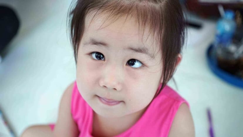 Nhược thị là gì? Nguyên nhân, dấu hiệu và phương pháp điều trị