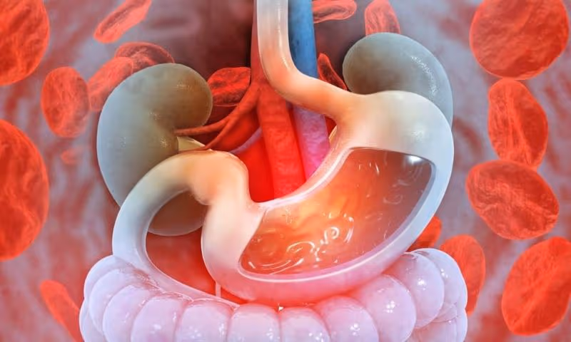 Xuất huyết tiêu hóa trên là tình trạng chảy máu xảy ra ở thực quản, dạ dày hoặc phần trên của tá tràng