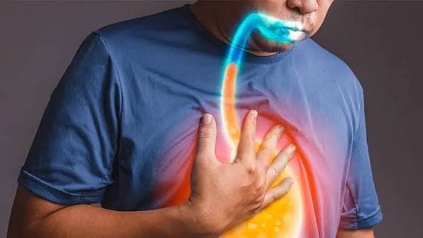 Trào ngược dạ dày thực quản (GERD) xảy ra khi dịch hoặc thức ăn từ dạ dày trào ngược lên thực quản