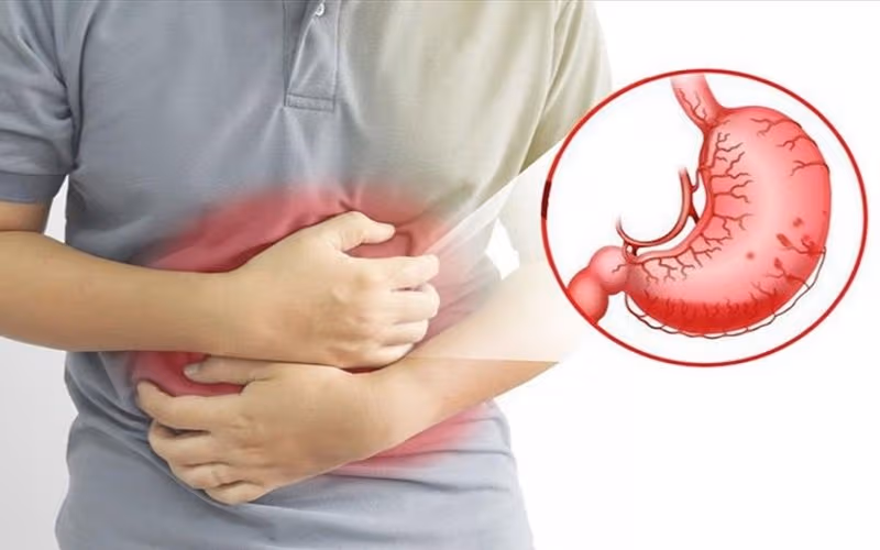 Viêm dạ dày xuất huyết có thể gây nguy hiểm đến tính mạng trong nhiều trường hợp