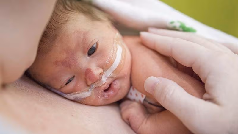 Trẻ sơ sinh bị thoát vị hoành có biểu hiện thở nhanh, thở gấp, phập phồng cánh mũi, rút lõm lồng ngực dữ dội khi hít vào.