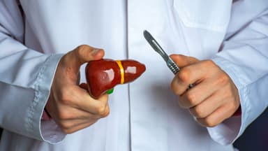Polyp túi mật là gì? Nguyên nhân, triệu chứng và cách điều trị