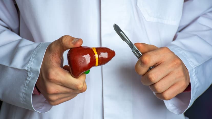 Polyp túi mật là gì? Nguyên nhân, triệu chứng và cách điều trị