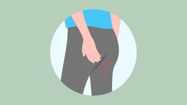 Rò hậu môn liên cơ thắt: Dấu hiệu nhận biết và phương pháp điều trị