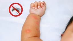 Sốt xuất huyết Dengue ở trẻ có nguy hiểm không?