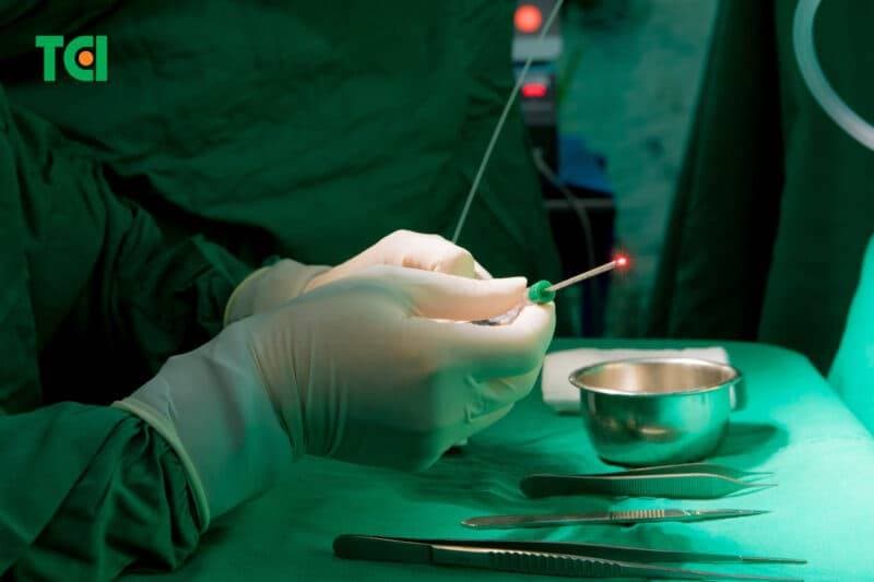 Điều trị rò hậu môn phức tạp thường cần can thiệp ngoại khoa, tùy thuộc vào đường rò và số lượng nhánh rò