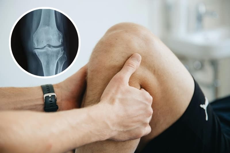 Khả năng giảm ma sát giữa các đầu xương giamr làm khe khớp hẹp dần và tăng nguy cơ hình thành gai xương