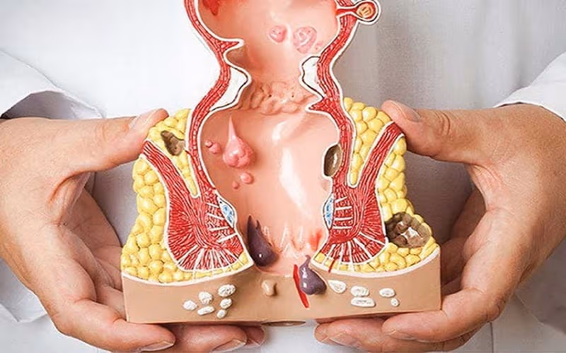 Người bệnh cần thăm khám và đánh giá tổn thương để có hướng điều trị hiệu quả