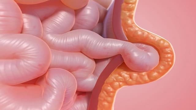 Thoát vị bẹn: Dấu hiệu nhận biết, nguyên nhân và cách điều trị