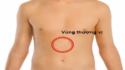 Thoát vị thượng vị là gì? Nguy hiểm không?