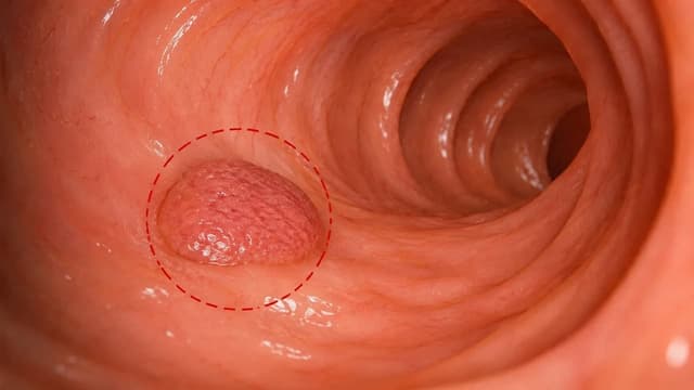 Tổn thương răng cưa không cuống nguy hiểm không? Cần xử trí ra sao?