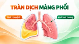 Nguyên nhân gây tràn dịch màng phổi và cách điều trị