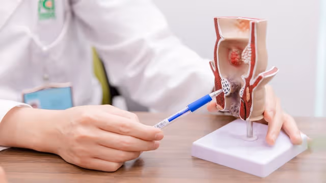 Trĩ nội là gì? Nguyên nhân, dấu hiệu nhận biết và cách chữa trĩ nội hiệu quả