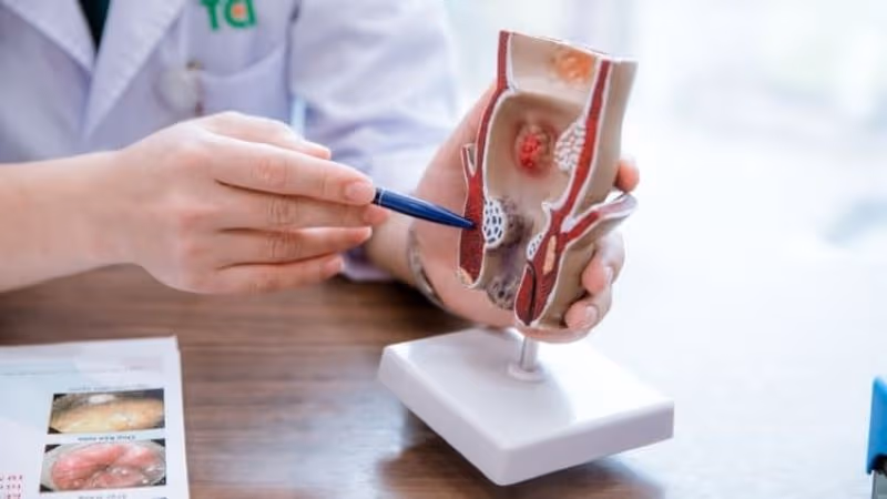 Bác sĩ cần kết hợp nhiều phương pháp để xác định có phải viêm tuyến hậu môn hay không và tìm nguyên nhân gây viêm