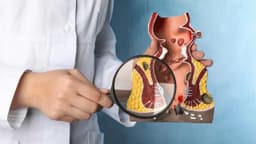 Nổi u quanh hậu môn là do đâu? Phải làm sao?