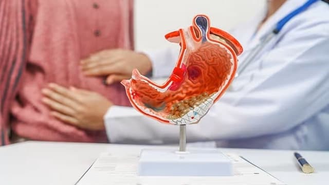Ung thư biểu mô tuyến dạ dày là gì? Cách chẩn đoán và điều trị
