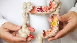 Ung thư đại tràng là gì? Dấu hiệu nhận biết, tầm soát và tiên lượng điều trị