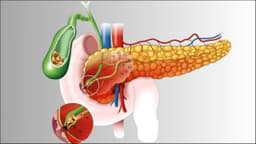 Ung thư túi mật: Dấu hiệu, nguyên nhân và cách chẩn đoán, điều trị