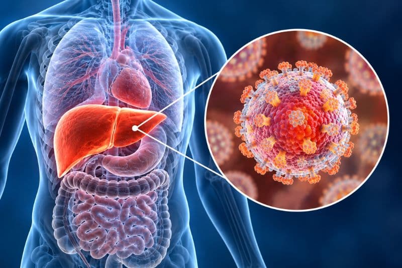 Viêm gan C là bệnh truyền nhiễm do virus HCV gây ra, xơ gan và ung thư biểu mô tế bào gan nếu không được kiểm soát.