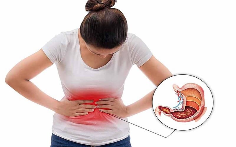 Viêm hành tá tràng là tổn thương thường gặp tại đoạn đầu của ruột non