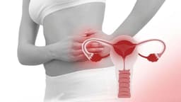Viêm vùng chậu và thông tin cần biết
