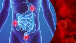 Xuất huyết tiêu hóa dưới: Nguyên nhân, dấu hiệu và cách xử trí
