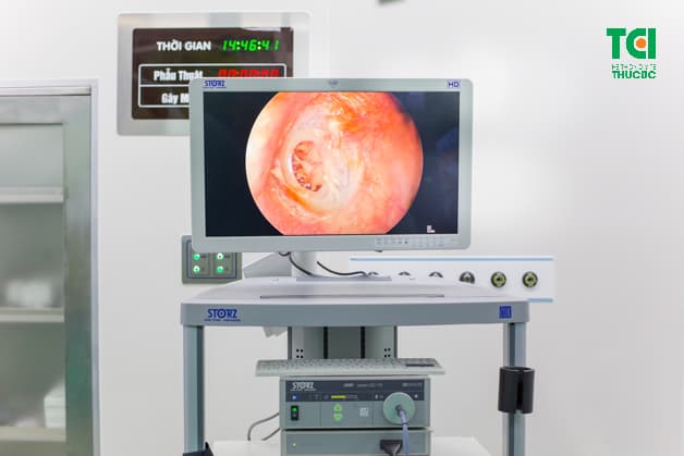 Dưới sự hỗ trợ của máy móc hiện đại, toàn bộ chi tiết hình ảnh của vùng tai mũi họng sẽ hiển thị rõ ràng, giúp bác sĩ chẩn đoán chính xác.