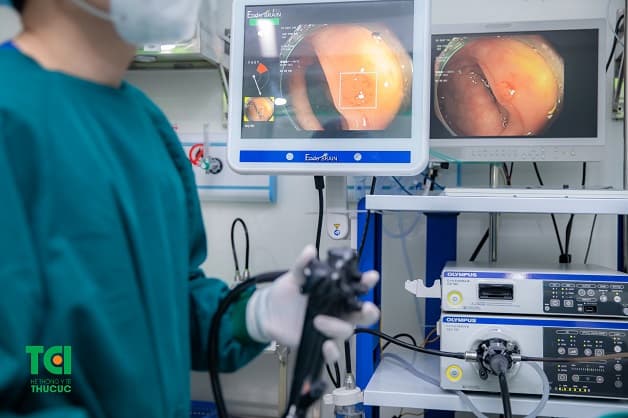 Nội soi NBI 5P tại khoa Thăm dò chức năng - Nội soi TCI 