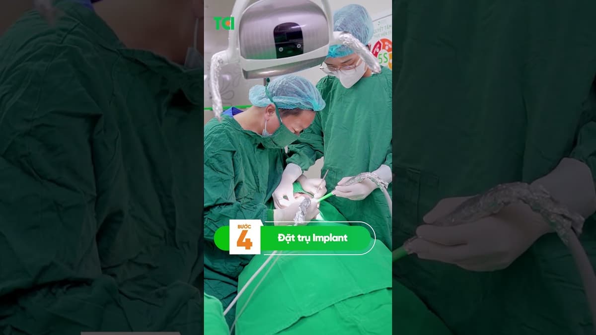 🦷 Trồng răng Implant gồm những bước nào? Mất bao lâu để có răng mới?